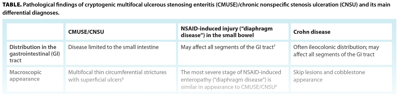TABLE. Pathological findings of cryptogenic multifocal ulcerous stenosing enteritis (CMUSE)/chronic nonspecific stenosis ulceration (CNSU) and its main differential diagnoses.