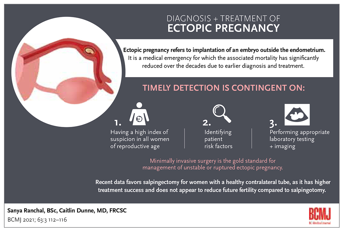 presentation of ectopic pregnancy