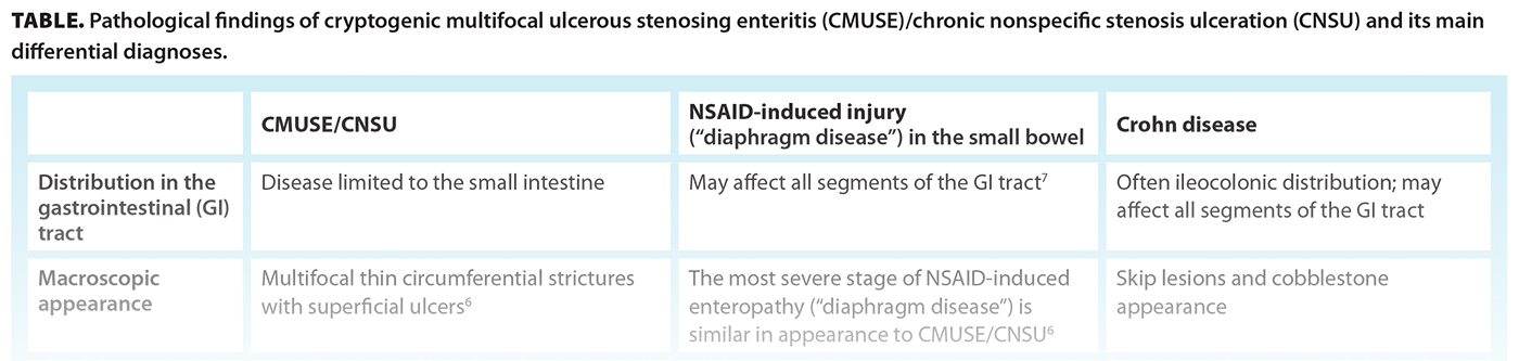 TABLE. Pathological findings of cryptogenic multifocal ulcerous stenosing enteritis (CMUSE)/chronic nonspecific stenosis ulceration (CNSU) and its main differential diagnoses.