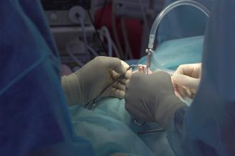 Laparoscopic gallbladder surgery