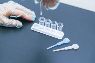 Polymerase chain reaction (PCR) testing