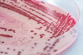 Listeriosis in a petri-dish up close and personal