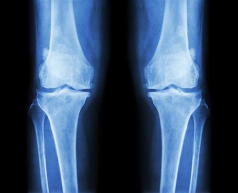 A knee X-ray