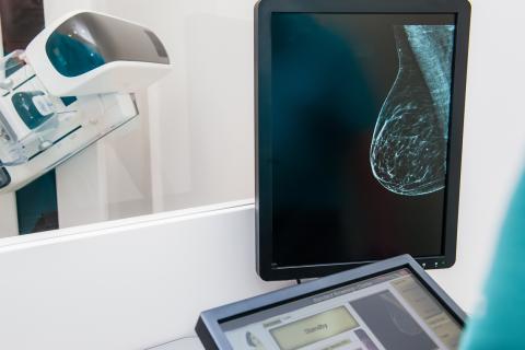 Mammography scanner