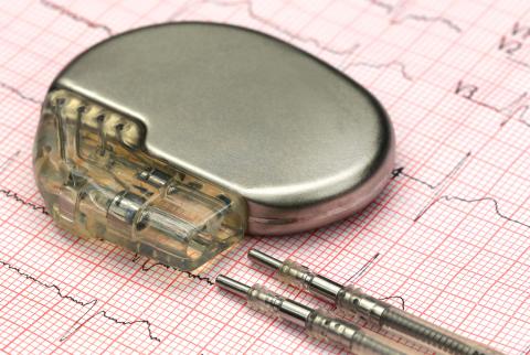 A pacemaker sits on top of an electrocardiograph