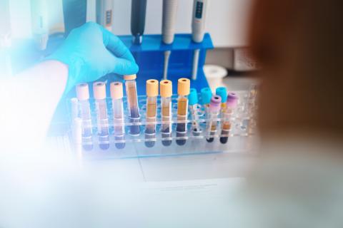 Test tubes with blood samples