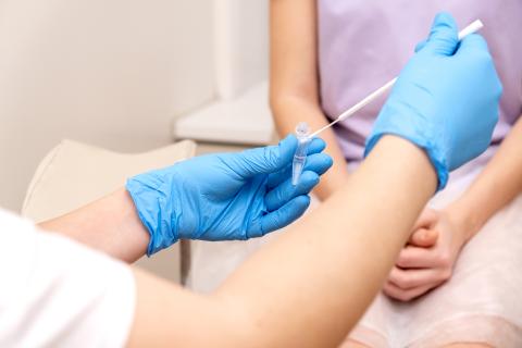 A gynecologist places a swab in a collection container
