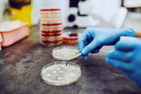 Petri dishes in a lab