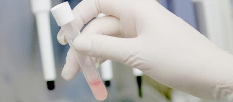 A gloved hand holds a blood sample