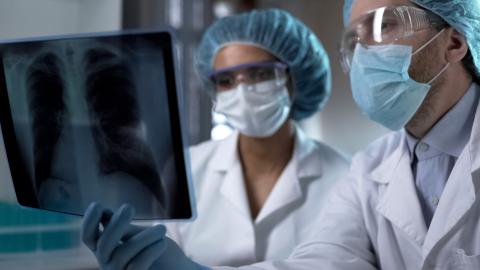 Doctors studying x-ray of lungs in lab, analyzing and discussing diagnosis