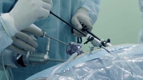 Laparoscopic surgery