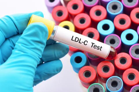 low density lipoprotein cholesterol