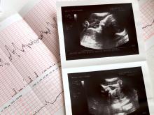 An ultrasound picture sits on top of an electrocardiogram readout