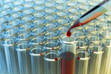 A sample of blood is transferred to a test tube