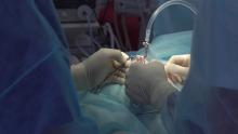 Laparoscopic gallbladder surgery