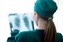 A doctor looks at an X-ray of a patient's lungs