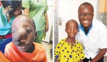 Samuel prior to the surgery and with Dr Alvin Nah Doe, a KBNF member and Liberia’s sole neurosurgeon, who participated in Samuel’s surgery and treatment.