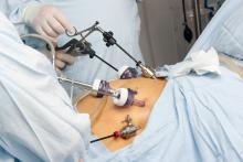 Surgeons perform a laparoscopic gastric bypass surgery