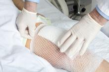 Mesh holds a knee replacement bandage in place.