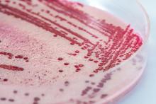 Listeriosis in a petri-dish up close and personal